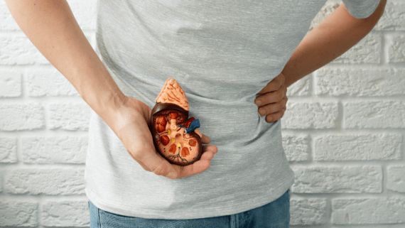 Tors d'una persona. Amb una mà subjecta la recreació d'un ronyó amb càlculs renals. Amb l'altra es toca la zona adolorida pel desplaçament dels càlculs